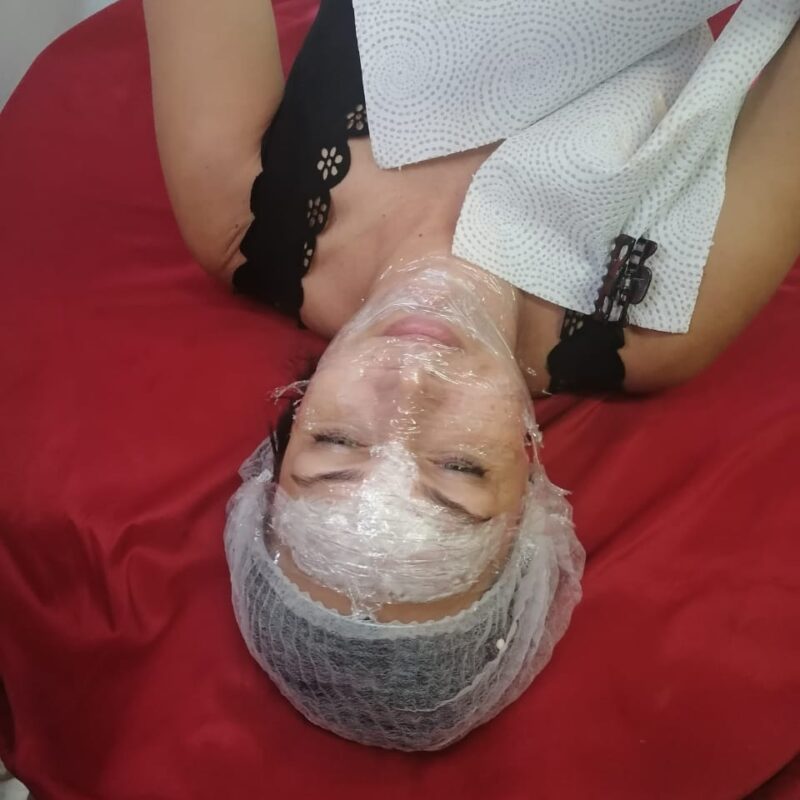 Fibroblast During treatment 15 Mar 2023