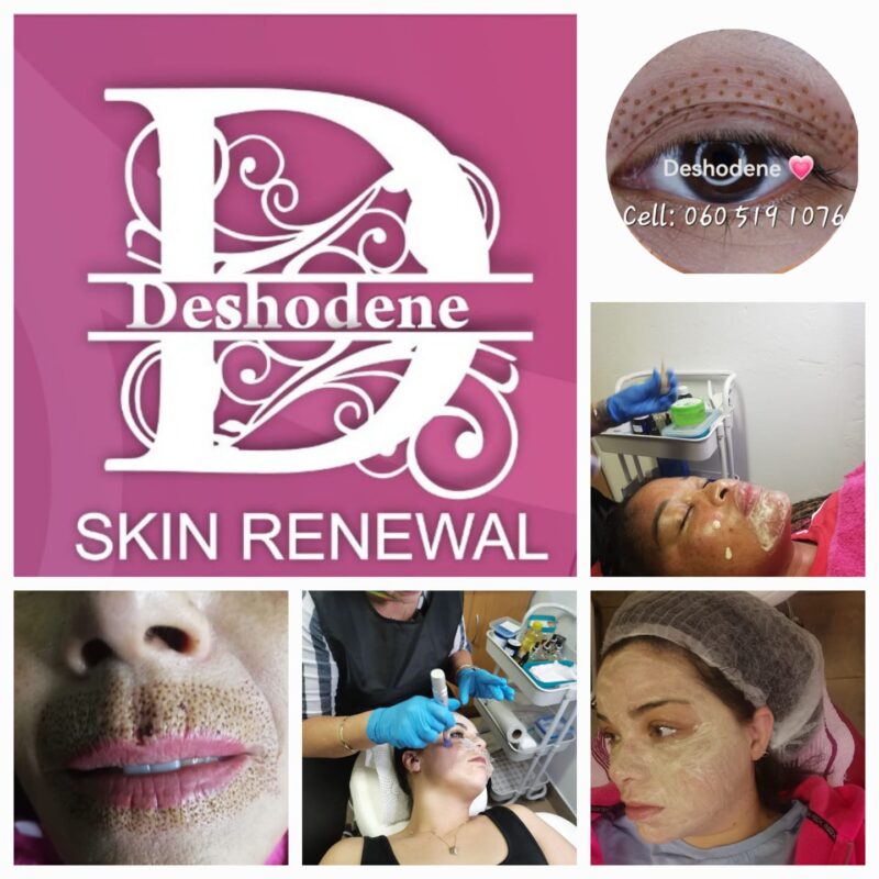 BB Glow Microneedling and Fibroblast